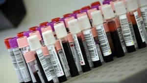 اختبار دم يتيح معرفة مدى الانتشار الفعلي لفيروس كورونا