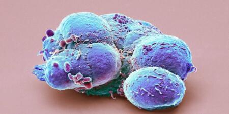 ما القيود التي أخّرت الباحثين عن تطوير العلاجات المعتمدة على الخلايا الجذعية؟